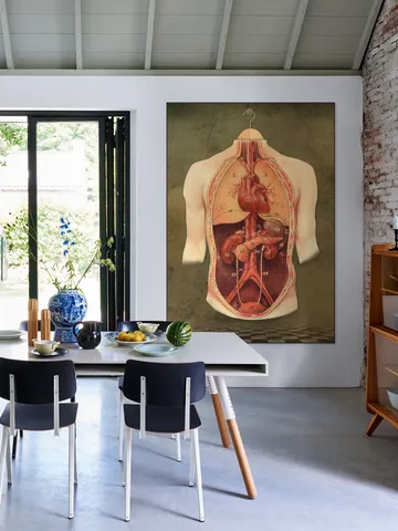 The Anatomy Lesson